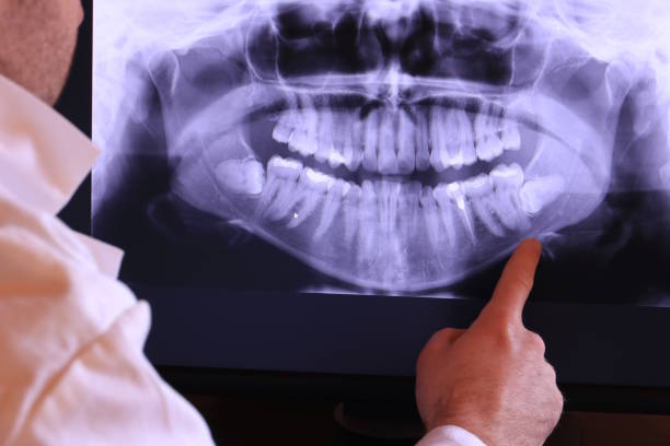 Best 24-Hour Emergency Dentist in Fort Meade, MD